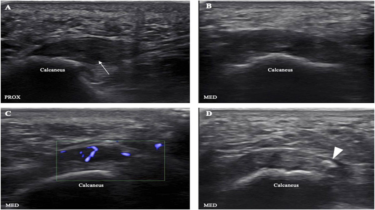 Clinical Journal of Sport Medicine