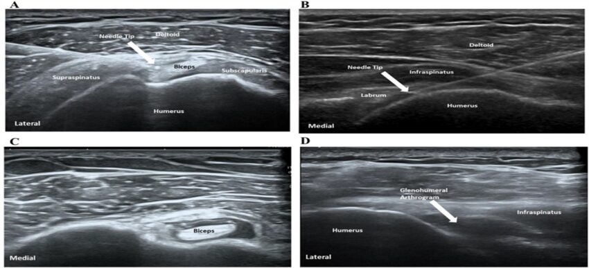 Clinical Journal of Sport Medicine