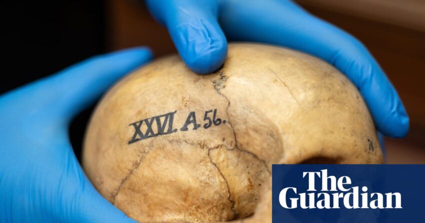 'Ruang Tengkorak' Universitas Edinburgh menyoroti sejarahnya yang rumit dengan sains rasis | Universitas Edinburgh