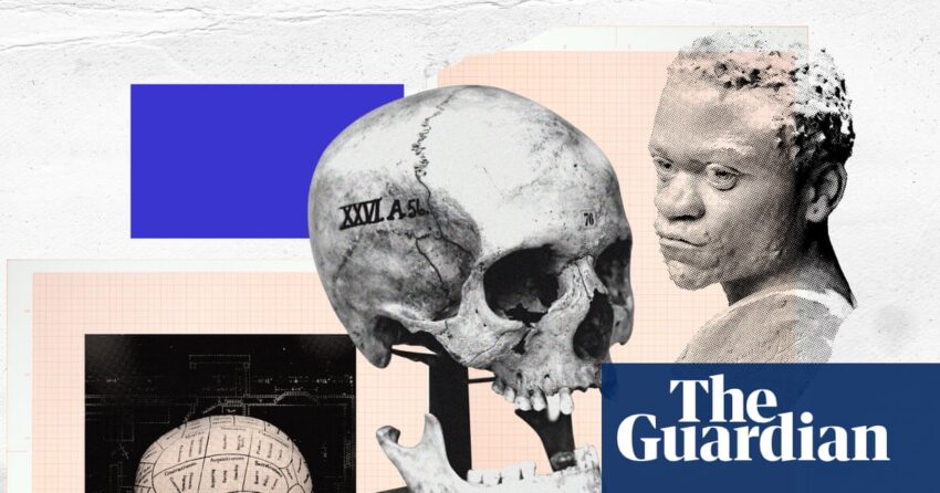 Tes Phrenology dan IQ: Kebangkitan sayap kanan dari Ilmu Ras Diskredited | Edinburgh